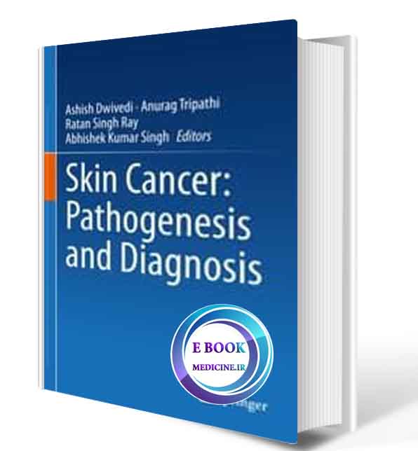 دانلود کتابSkin Cancer: Pathogenesis and Diagnosis 1st ed. 2021 (ORIGINAL PDF)